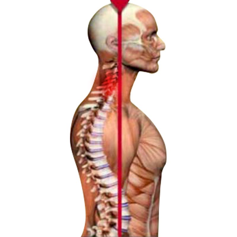 Cervical Pain stage1 | Global Health