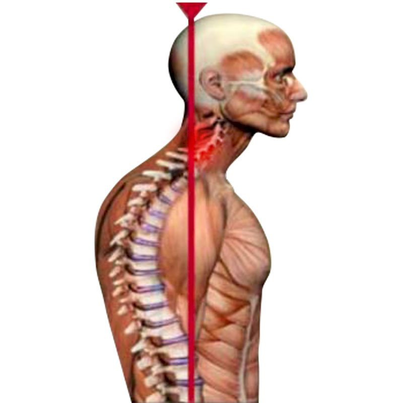 Cervical Pain stage2 | Global Health