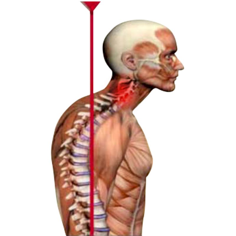 Cervical Pain stage3 | Global Health