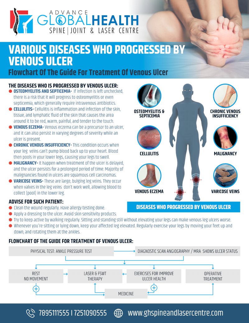 VARIOUS DISEASES WHO PROGRESSED BY VENOUS ULCER: Flowchart Of The Guide For Treatment Of Venous Ulcer
