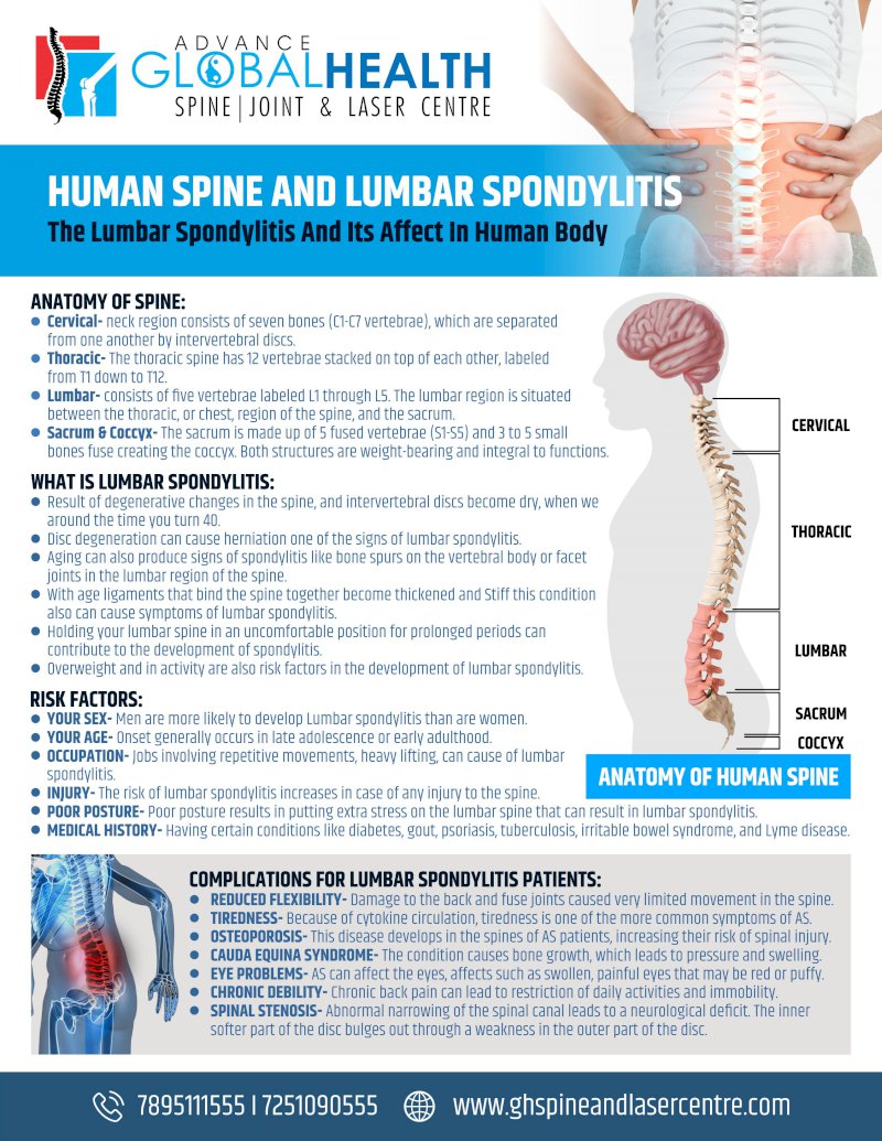 HUMAN SPINE AND LUMBAR SPONDYLITIS: The Lumbar Spondylitis And Its Affect In Human Body