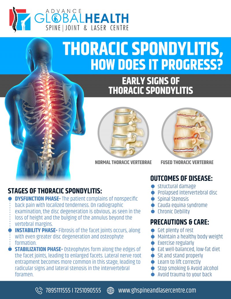 THORACIC SPONDYLITIS, HOW DOES IT PROGRESS