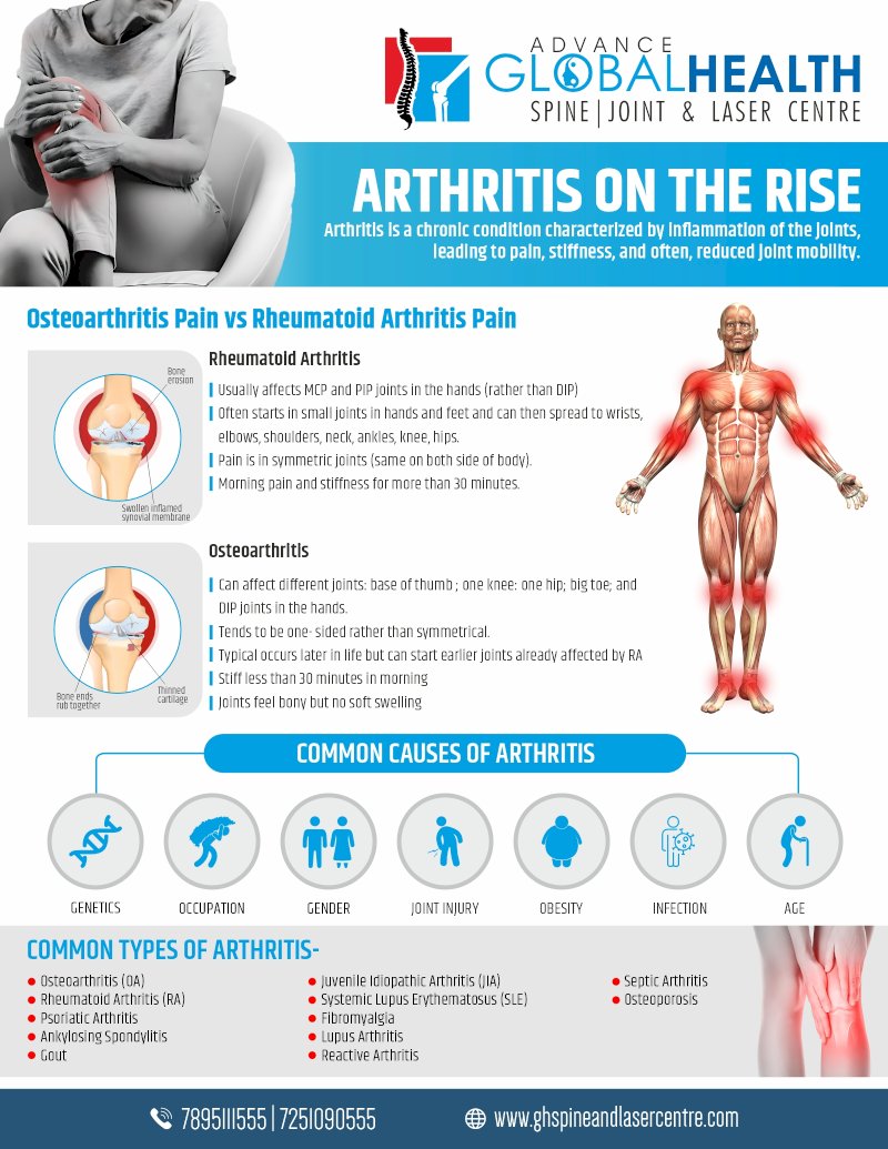 ARTHRITIS ON THE RISE