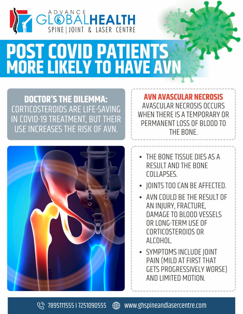 POST COVID PATIENTS MORE LIKELY TO HAVE AVN