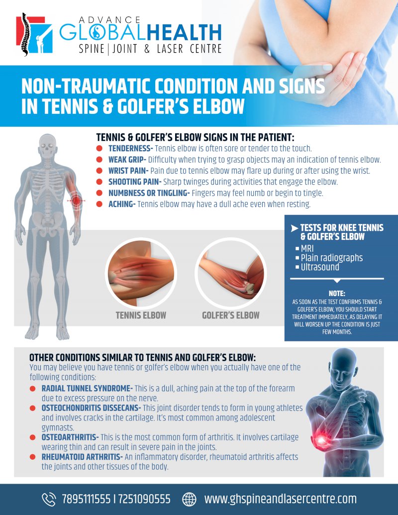NON-TRAUMATIC CONDITION AND SIGNS IN TENNIS & GOLFER’S ELBOW