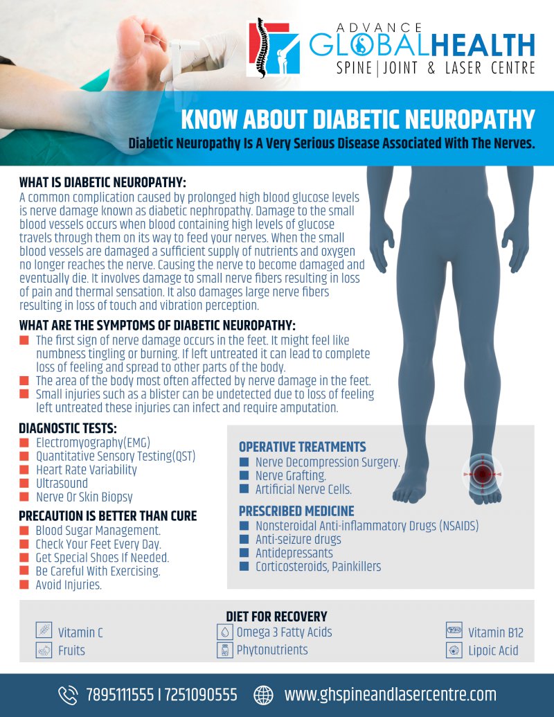 KNOW ABOUT DIABETIC NEUROPATHY: Diabetic Neuropathy Is A Very Serious Disease Associated With The Nerves.