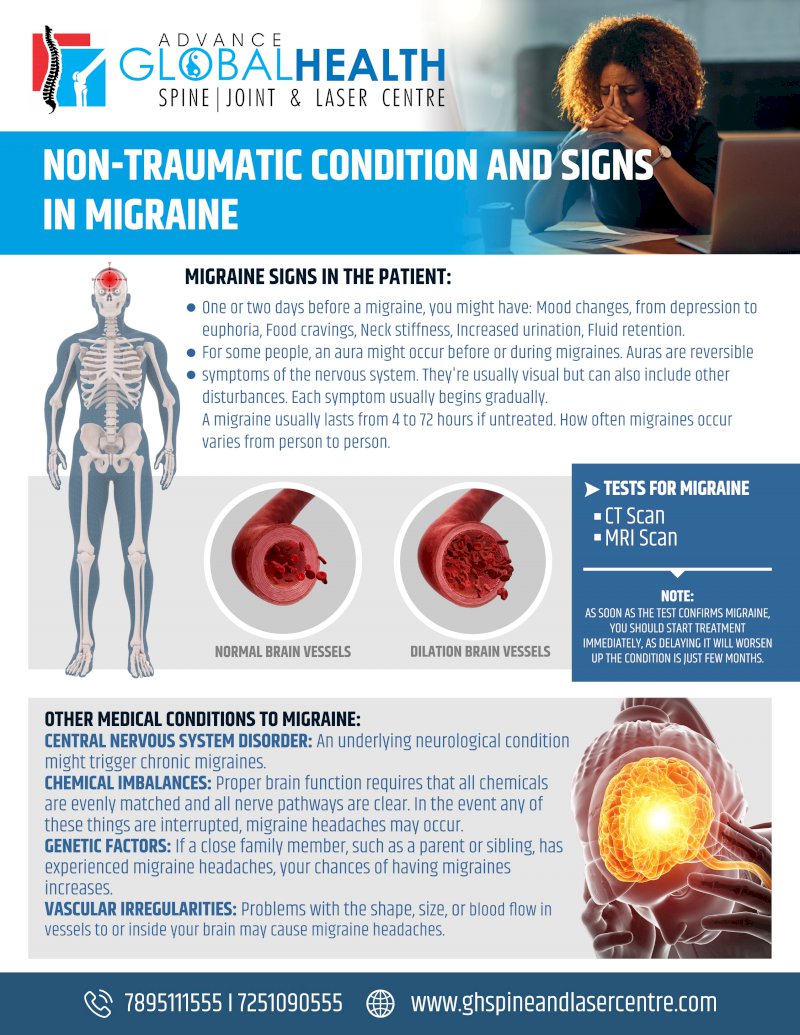 NON-TRAUMATIC CONDITION AND SIGNS IN MIGRAINE