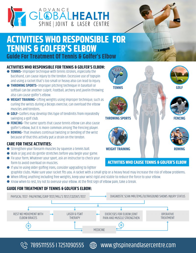 ACTIVITIES WHO RESPONSIBLE  FOR  TENNIS & GOLFER’S ELBOW: Guide For Treatment Of Tennis & Golfer’s Elbow