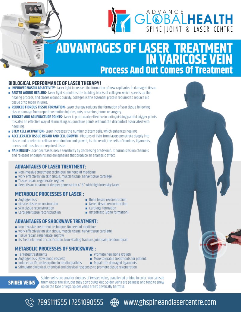 ADVANTAGES OF LASER  TREATMENT IN VARICOSE VEIN: Process And Out Comes Of Treatment