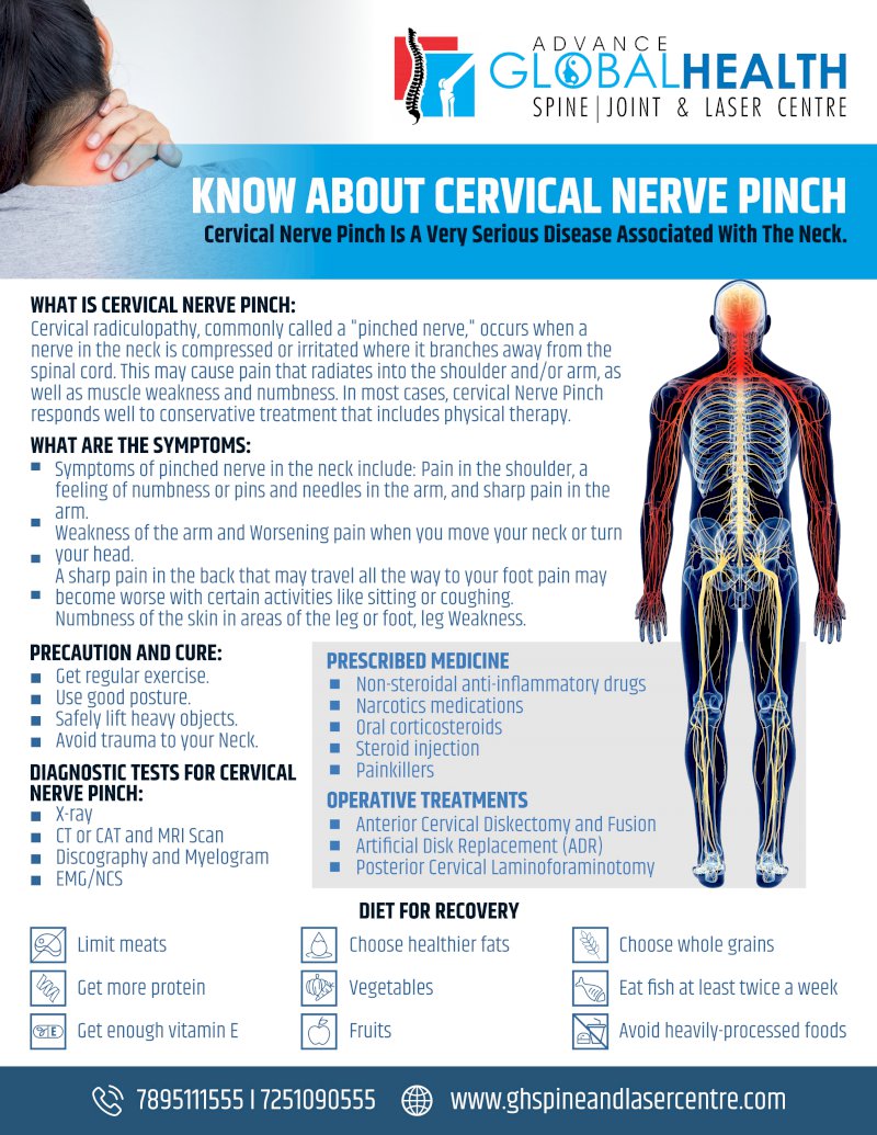 KNOW ABOUT CERVICAL NERVE PINCH: Cervical Nerve Pinch Is A Very Serious Disease Associated With The Neck