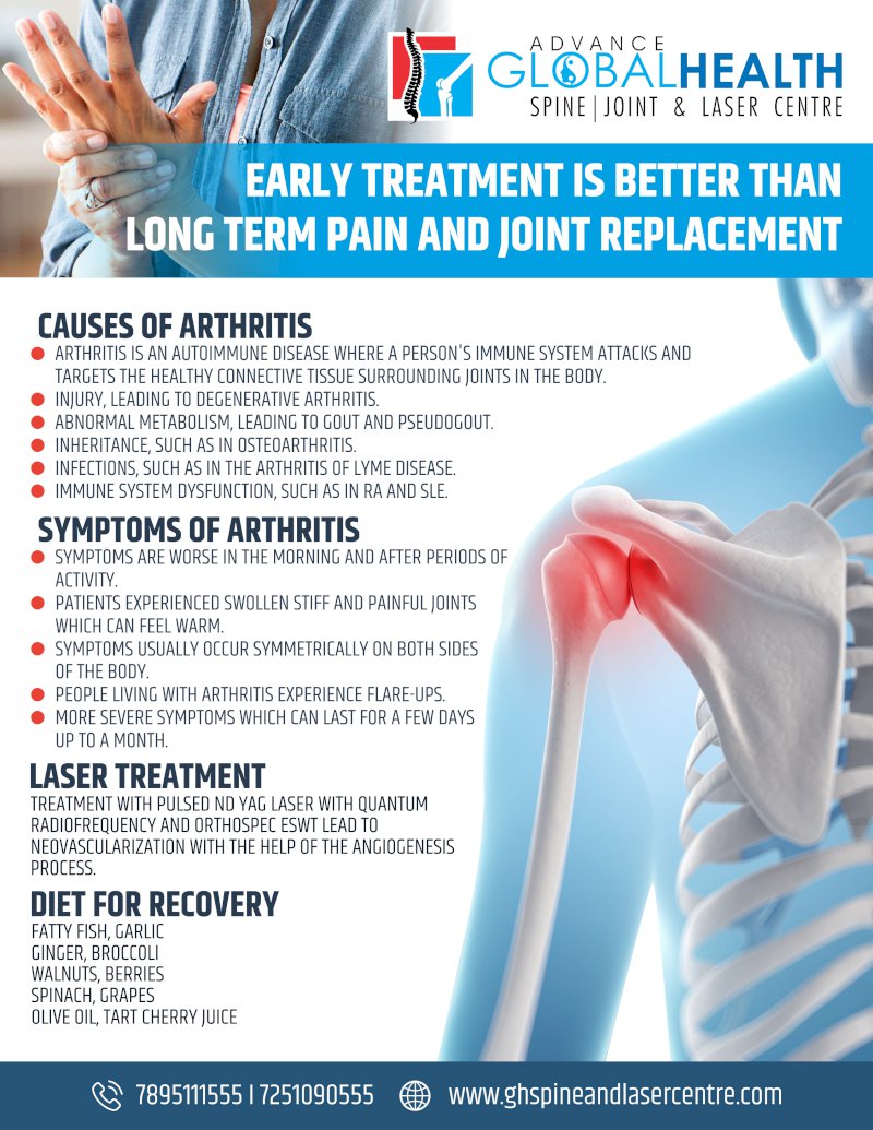 EARLY TREATMENT IS BETTER THAN LONG TERM PAIN AND JOINT REPLACEMENT