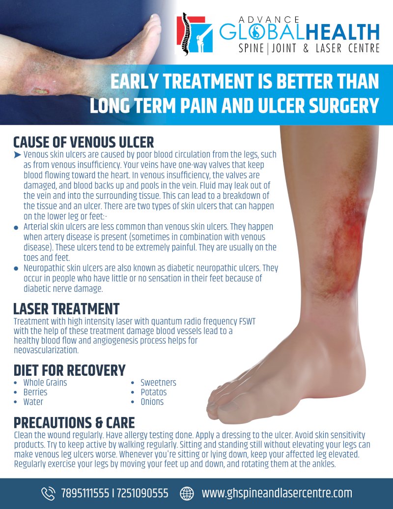 EARLY TREATMENT IS BETTER THAN LONG TERM PAIN AND ULCER SURGERY