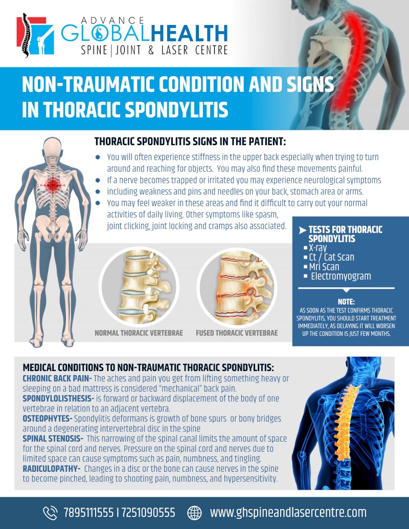 NON-TRAUMATIC CONDITION AND SIGNS IN THORACIC SPONDYLITIS