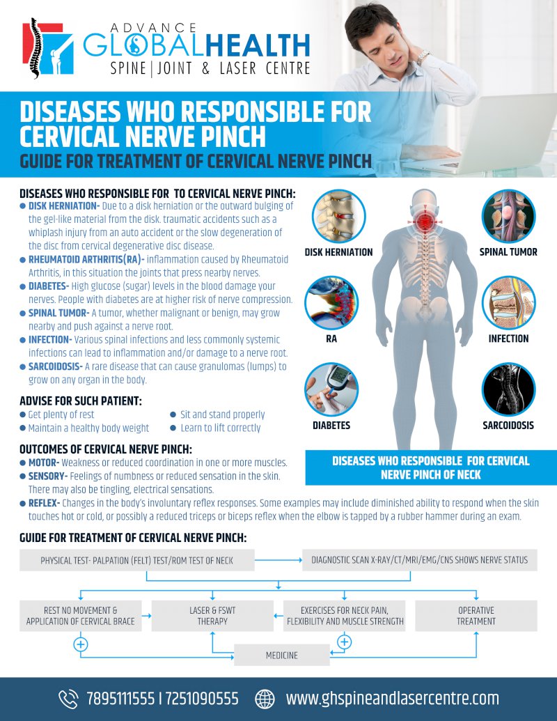 DISEASES WHO RESPONSIBLE FOR CERVICAL NERVE PINCH: GUIDE FOR TREATMENT OF CERVICAL NERVE PINCH