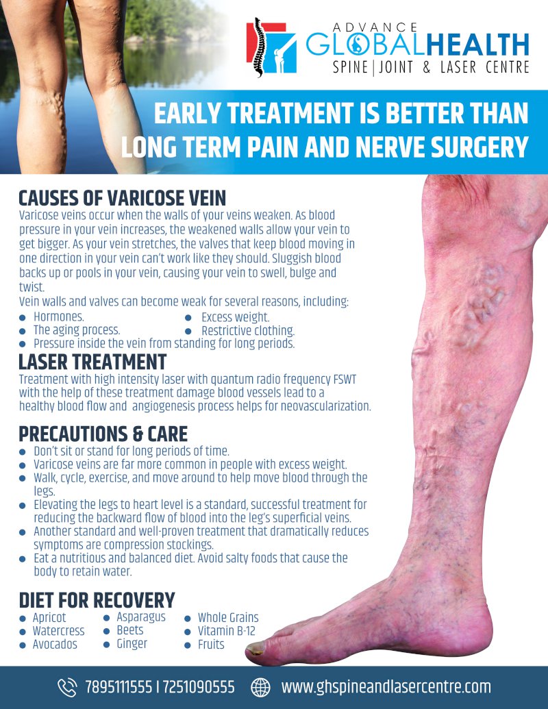 EARLY TREATMENT IS BETTER THAN LONG TERM PAIN AND VIEN SURGERY