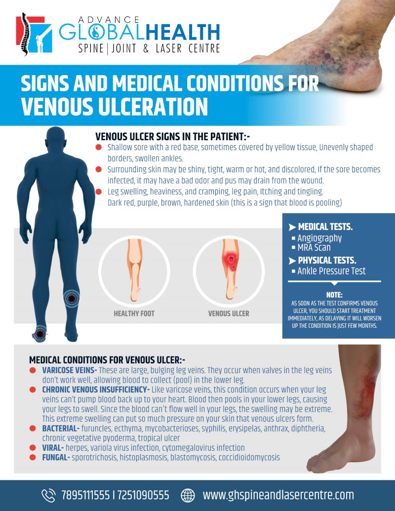 SIGNS AND MEDICAL CONDITIONS FOR VENOUS ULCERATION