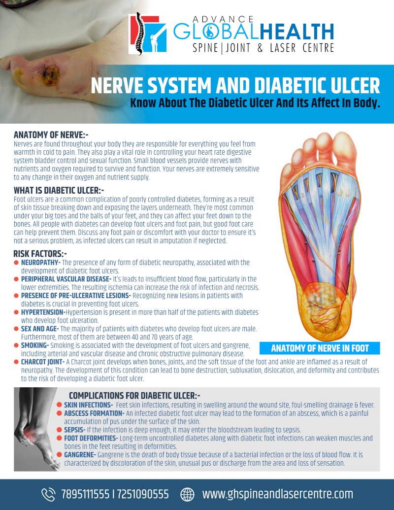 NERVE SYSTEM AND DIABETIC ULCER; Know About The Diabetic Ulcer And Its Affect In Body