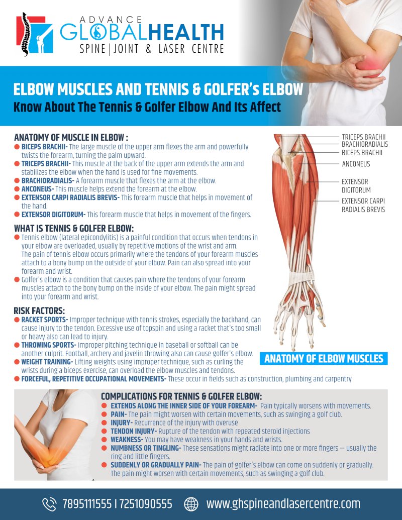 ELBOW MUSCLES AND TENNIS & GOLFER’s ELBOW: Know About The Tennis & Golfer Elbow And Its Affect