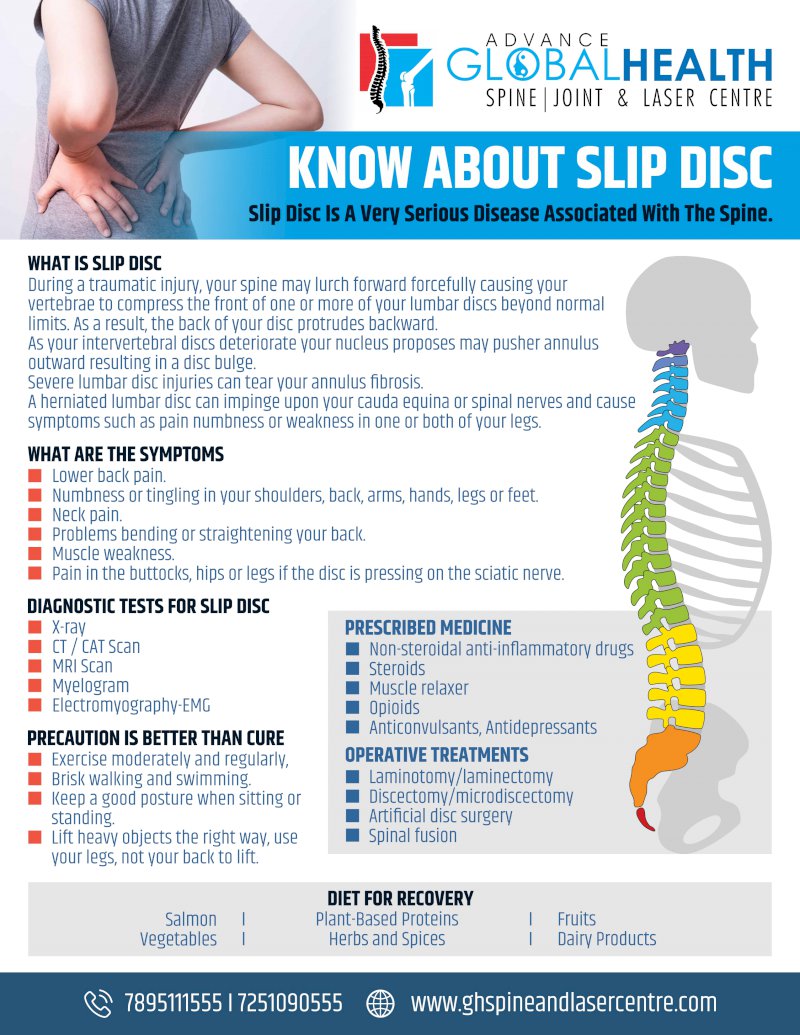 KNOW ABOUT SLIP DISC: Slip Disc Is A Very Serious Disease Associated With The Spine.