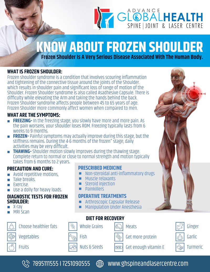 KNOW ABOUT FROZEN SHOULDER: Frozen Shoulder Is A Very Serious Disease Associated With The Human Body.