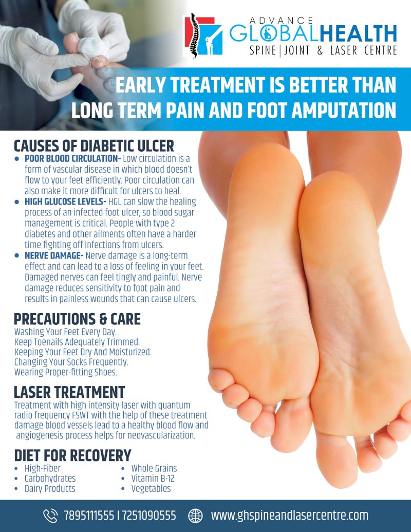 EARLY TREATMENT IS BETTER THAN LONG TERM PAIN AND FOOT AMPUTATION