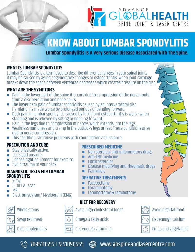 KNOW ABOUT LUMBAR SPONDYLITIS: Lumbar Spondylitis Is A Very Serious Disease Associated With The Spine