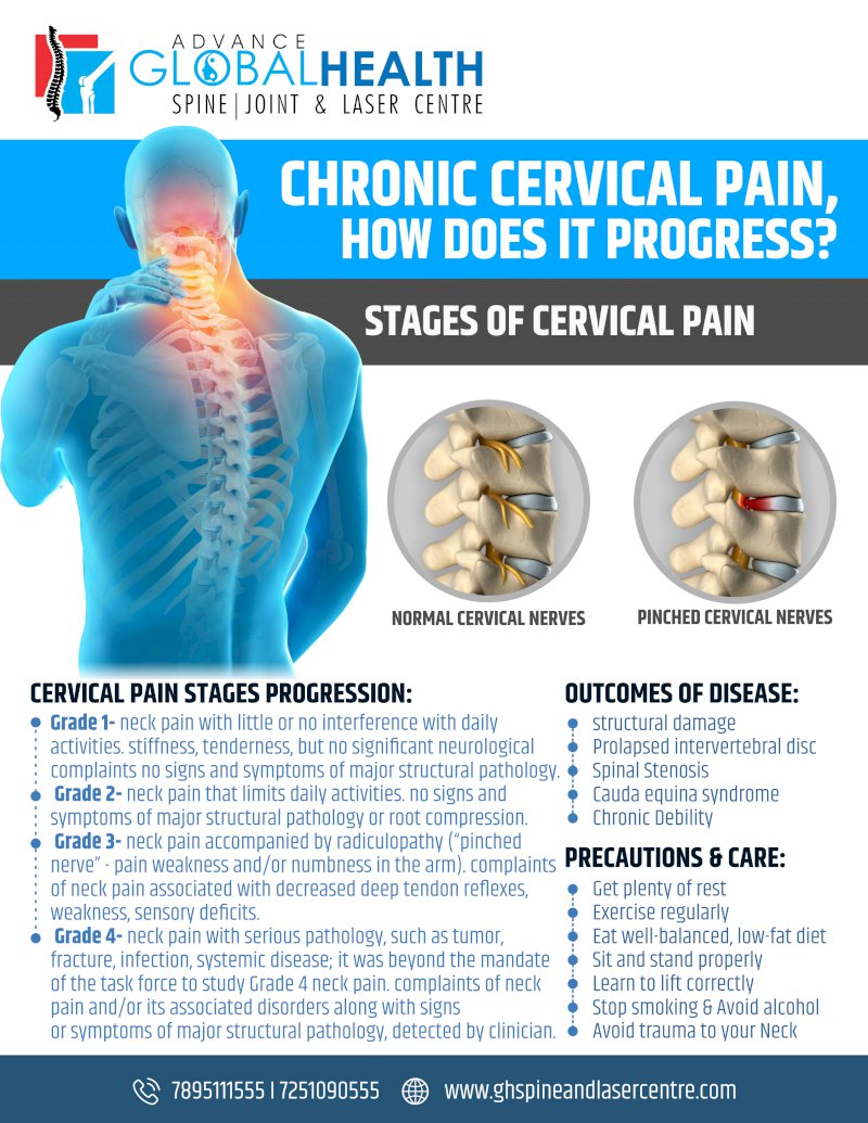 CHRONIC CERVICAL PAIN, HOW DOES IT PROGRESS