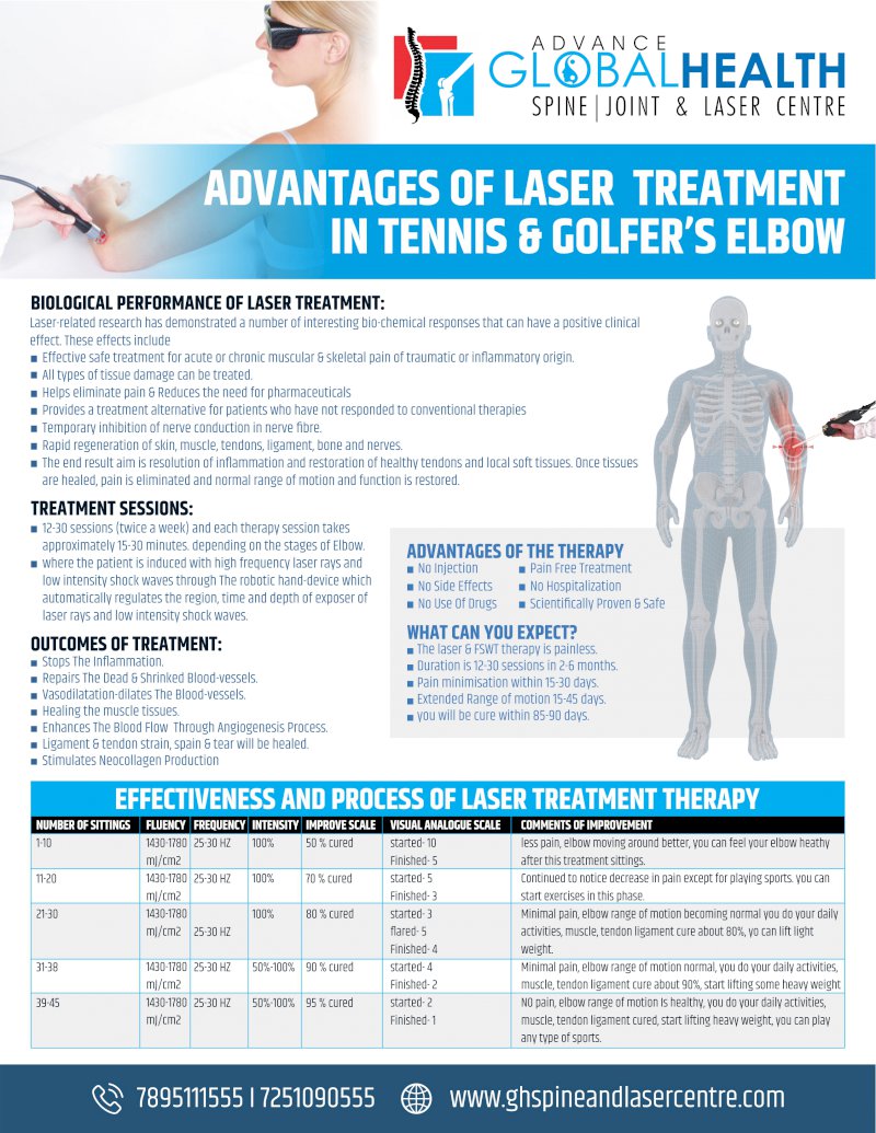 ADVANTAGES OF LASER  TREATMENT  IN TENNIS & GOLFER’S ELBOW