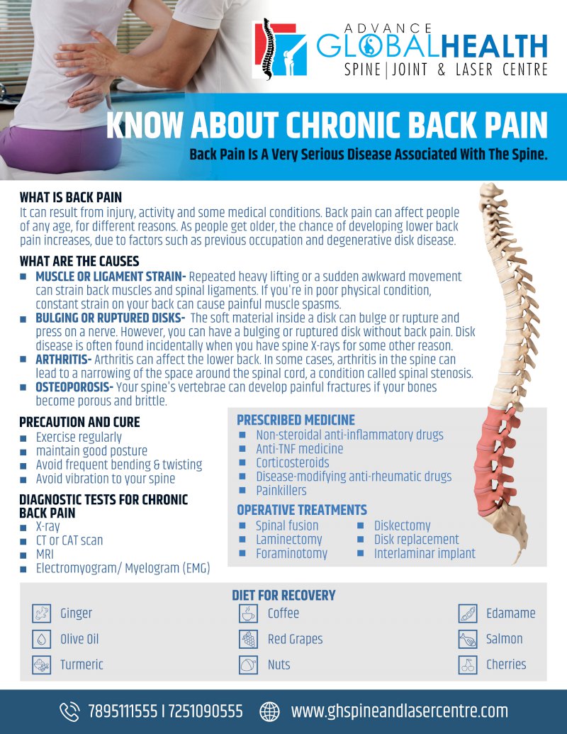KNOW ABOUT CHRONIC BACK PAIN: Back Pain Is A Very Serious Disease Associated With The Spine.