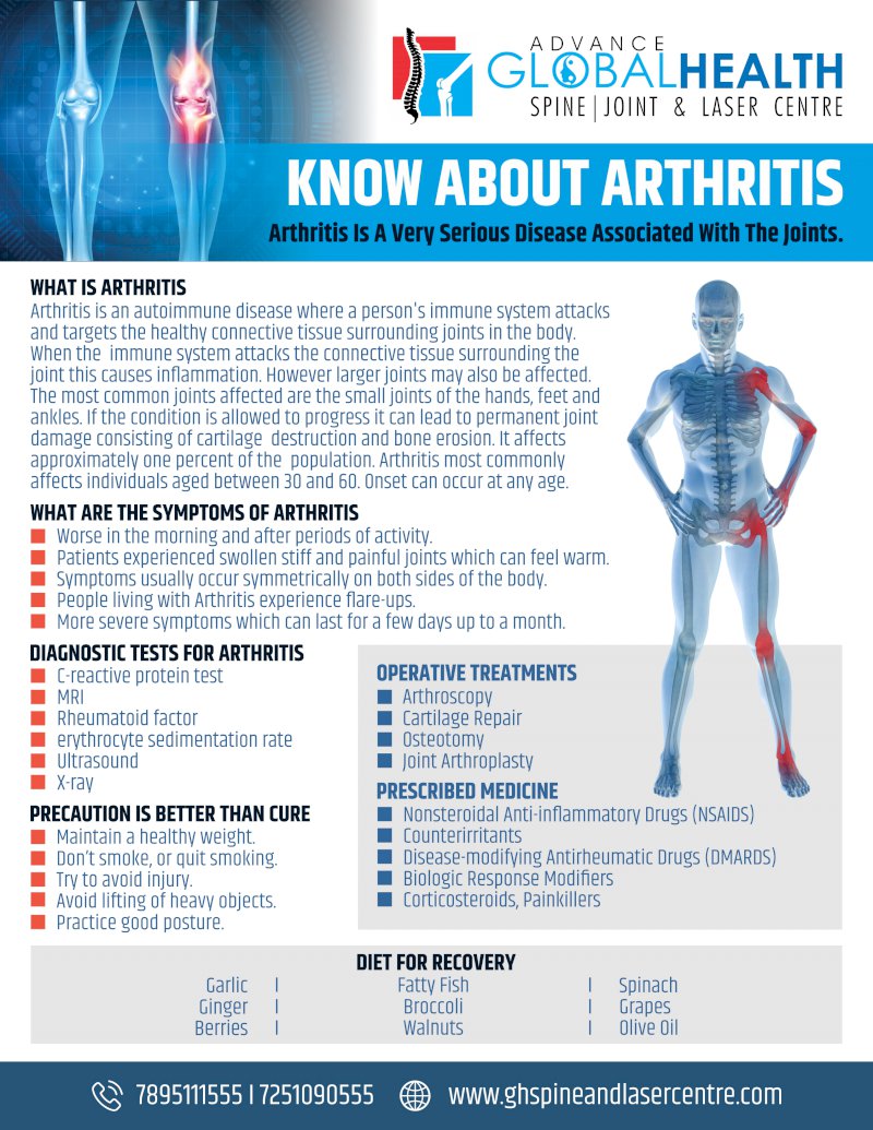 KNOW ABOUT ARTHRITIS: Arthritis Is A Very Serious Disease Associated With The Joints.