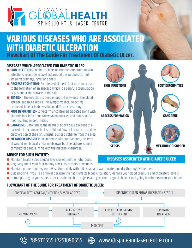 VARIOUS DISEASES WHO ARE ASSOCIATED WITH DIABETIC ULCERATION: Flowchart Of The Guide For Treatment Of Diabetic ULcer.