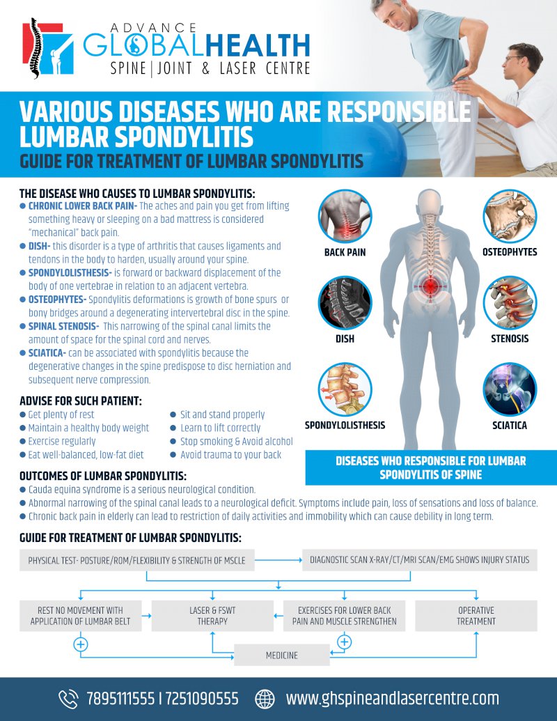  VARIOUS DISEASES WHO ARE RESPOSIBLE FOR LUMBAR SPONDYLITIS: GUIDE FOR TREATMENT OF LUMBAR SPONDYLITIS