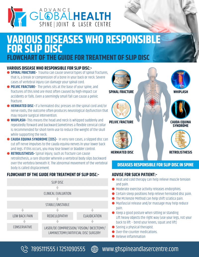 VARIOUS DISEASES WHO RESPONSIBLE FOR SLIP DISC: GUIDE FOR TREATMENT OF SLIP DISC