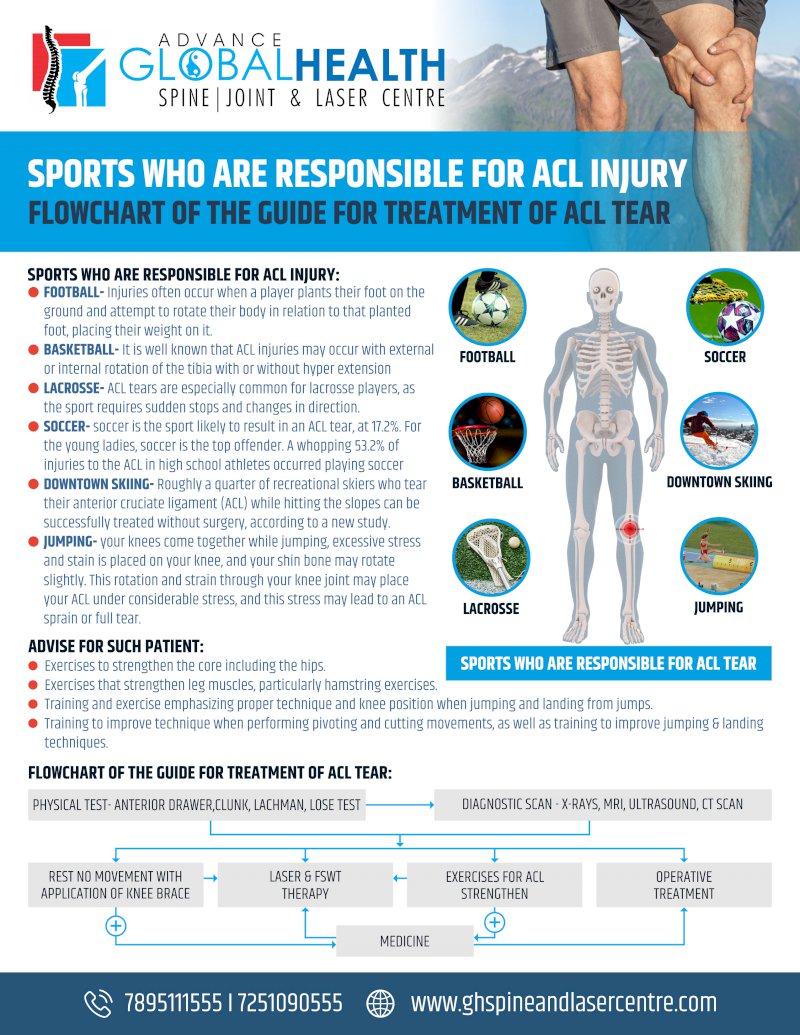 SPORTS WHO ARE RESPONSIBLE FOR ACL INJURY: FLOWCHART OF THE GUIDE FOR TREATMENT OF ACL TEAR