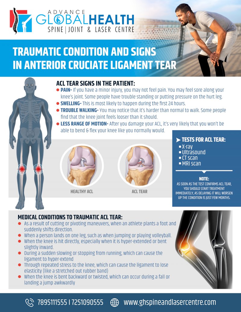 TRAUMATIC CONDITION AND SIGNS IN ANTERIOR CRUCIATE LIGAMENT TEAR