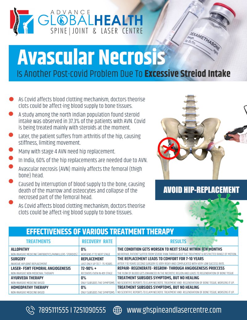 Avascular Necrosis Is Another Post-covid Problem Due To Excessive Steroid Intake  