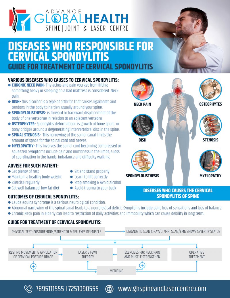 DISEASES WHO RESPONSIBLE FOR CERVICAL SPONDYLITIS: GUIDE FOR TREATMENT OF CERVICAL SPONDYLITIS