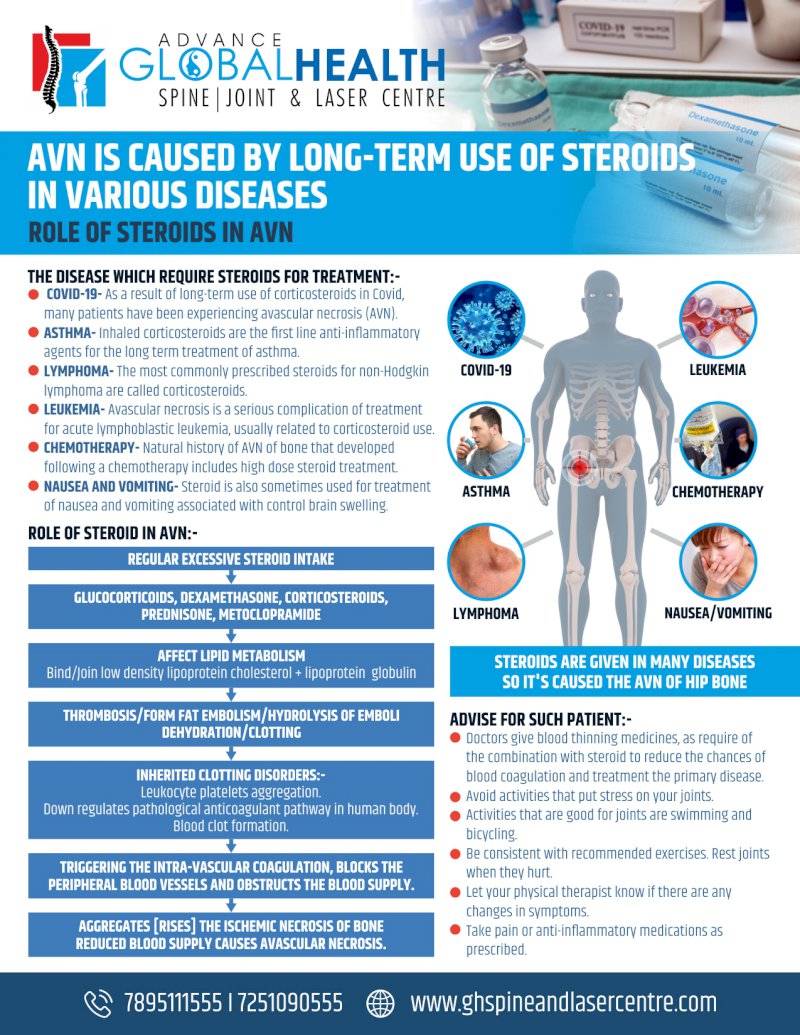AVN IS CAUSED BY LONG-TERM USE OF STEROIDS IN VARIOUS DISEASES IN VARIOUS DISEASES
