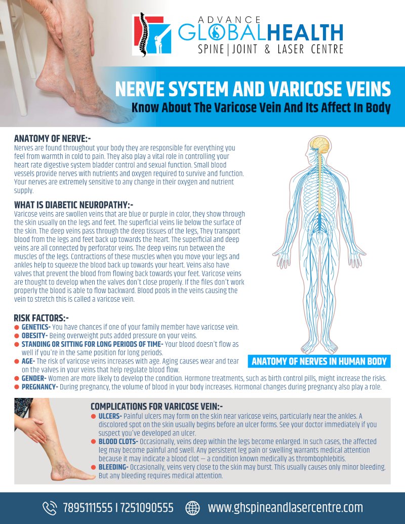 NERVE SYSTEM AND VARICOSE VEINS: Know About The Varicose Vein And Its Affect In Body