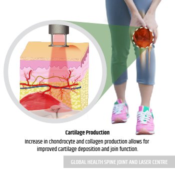 CARTILAGE PRODUCTION  | Global Health