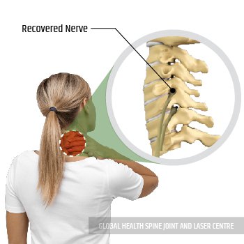 RECOVERED NERVE | Global Health