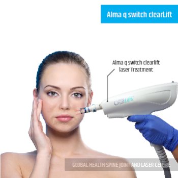 Alma q switch clearLift | Global Health