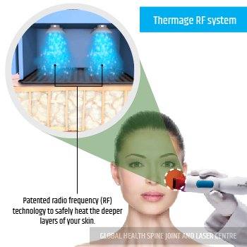Thermage RF system | Global Health