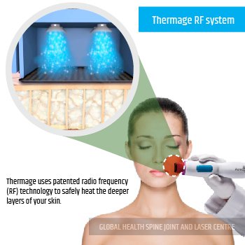 THERMAGE RF SYSTEM | Global Health