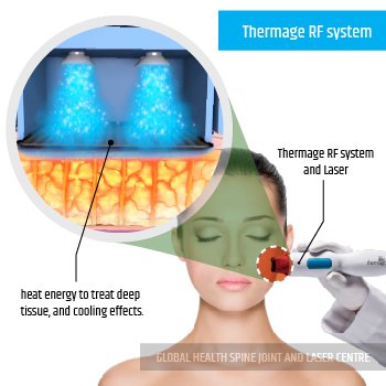 Thermage RF system | Global Health