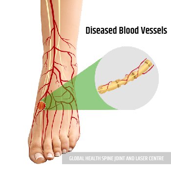 REPAIRING PHASE | Global Health