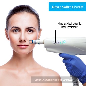 Alma q switch clearlift laser Treatment | Global Health