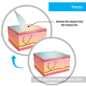 Process | Global Health